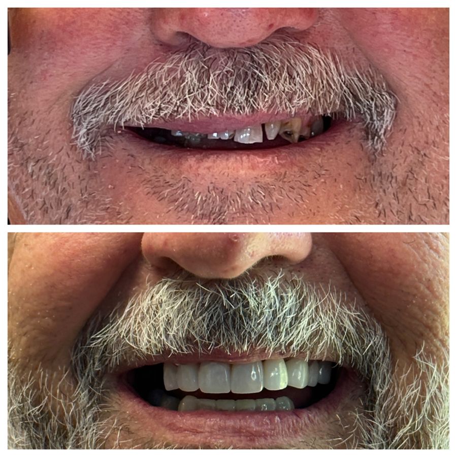 Before-and-after dental result, case 9