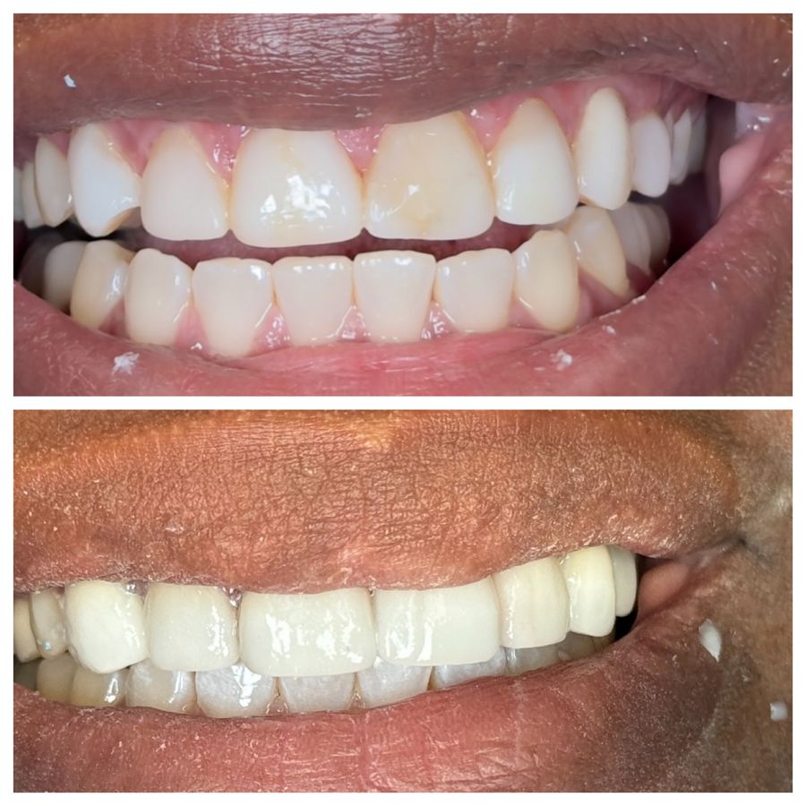Before-and-after dental result, case 8