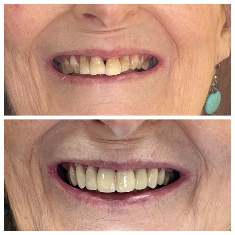 Before-and-after dental result, case 10